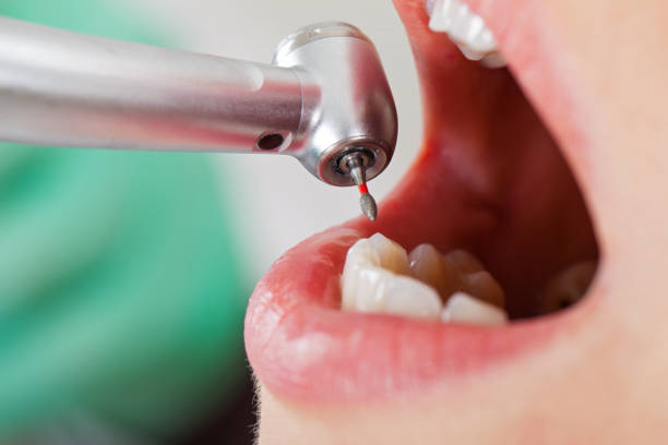 Best Emergency Denture Repair in Richfield, WI